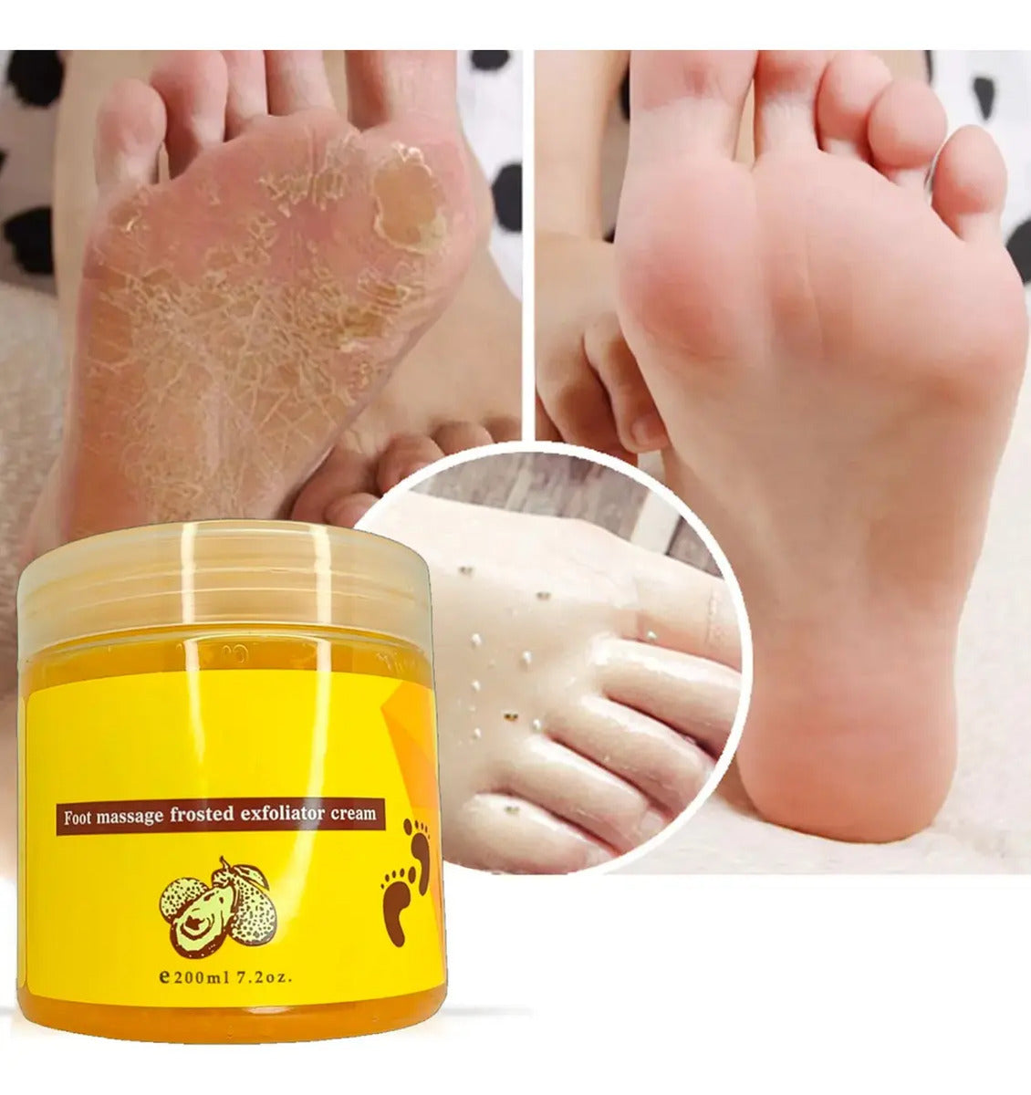 Exfoliante Gel Para Pies Con Colágeno Y Aguacate 200 Ml